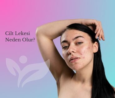 Cilt Lekesi Neden Olur?