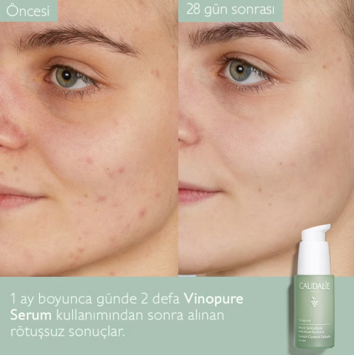 Caudalie Vinopure Blemish Control Salicylic Serum 30 Ml - 6