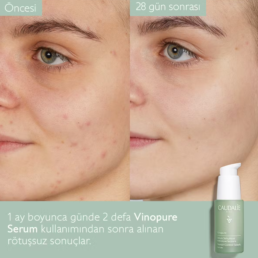Caudalie Vinopure Blemish Control Salicylic Serum 30 Ml - 6