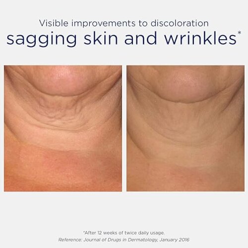 Firming Üçlü Sıkılaştırıcı Boyun Kremi 80gr - 2