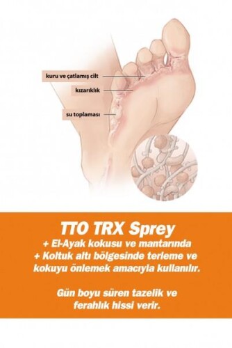 Tto Thermal Terex Ter Önleyici Sprey 50 Ml - 3